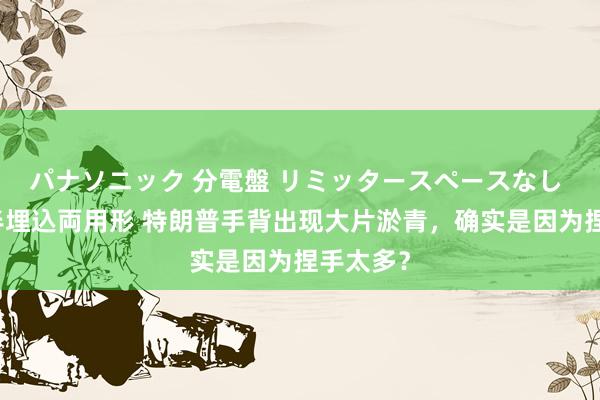 パナソニック 分電盤 リミッタースペースなし 露出・半埋込両用形 特朗普手背出现大片淤青，确实是因为捏手太多？
